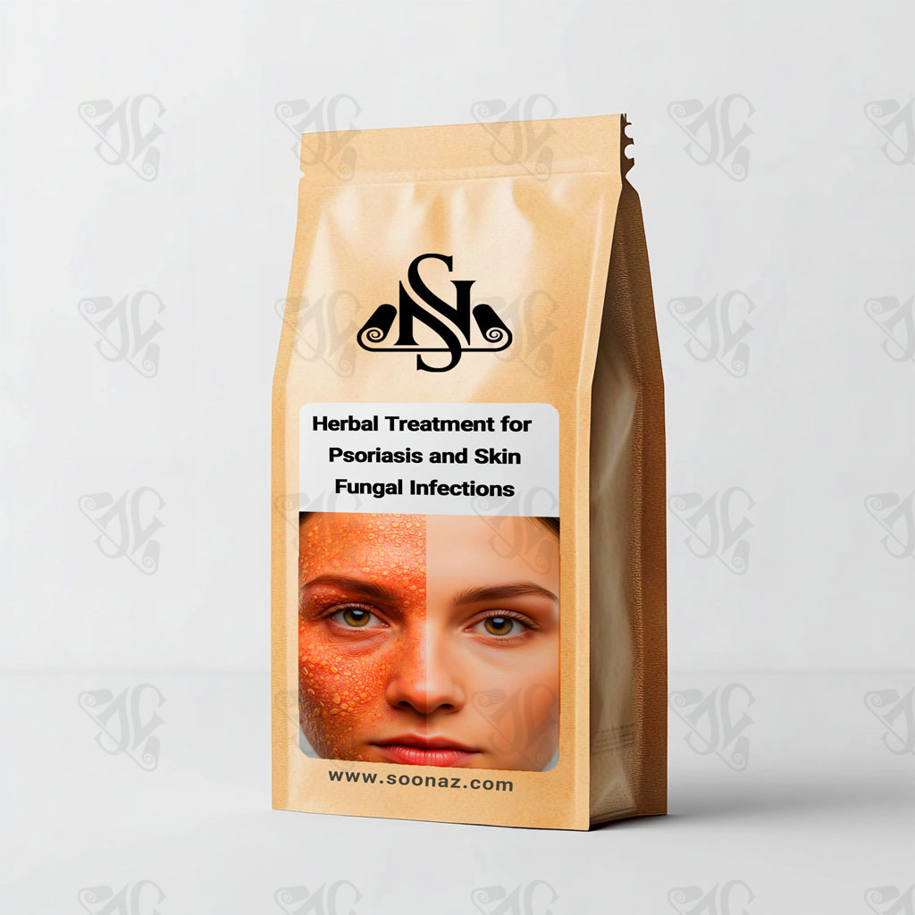Herbal Treatment for Psoriasis and Skin Fungal Infections