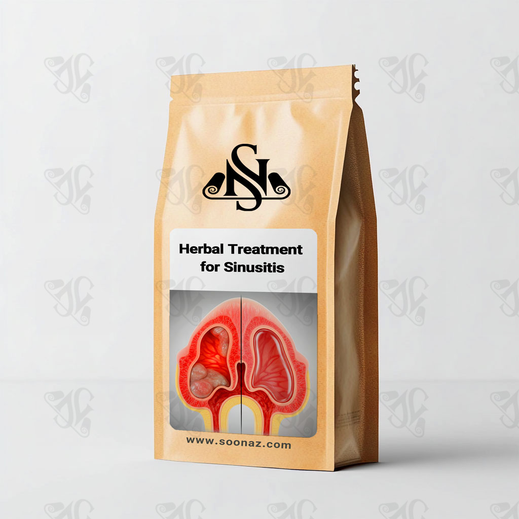 Herbal Treatment for Sinusitis