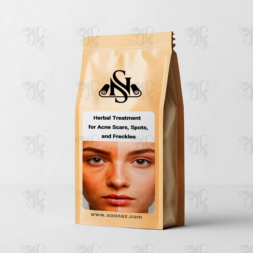 Herbal Treatment for Acne Scars, Spots, and Freckles