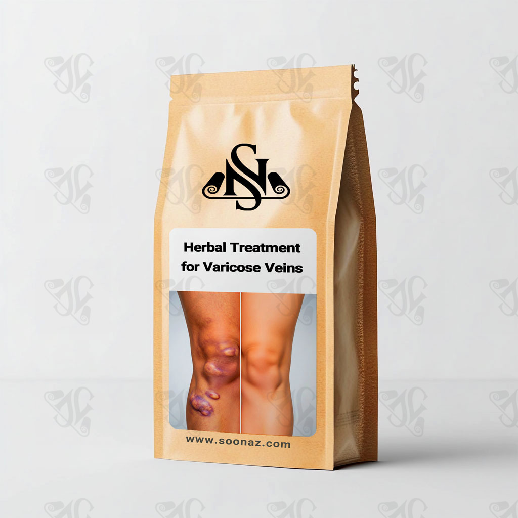 Herbal Treatment for Varicose Veins